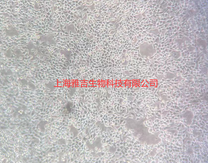 人恶性黑色素瘤细胞WM115