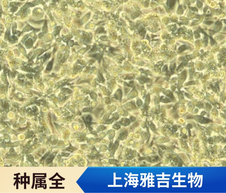 小鼠乳腺癌细胞带绿色荧光4T1/GFP