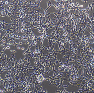 转染了microRNA-mock基因的阴性对照细胞Hela-mock