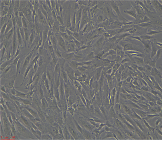 人乳腺原发性导管癌HCC202/LUC(带荧光素酶)