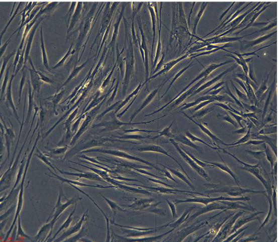 人乳腺导管癌细胞（三阴性）HCC2157/LUC(带荧光素酶)