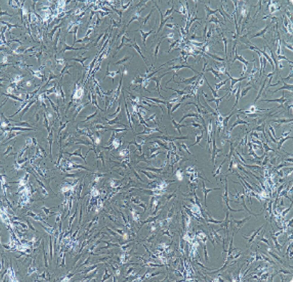 人骨肉瘤细胞带绿色荧光U-2OS/GFP